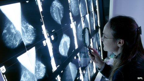 Women Are Dying Needlessly From Breast Cancer, Experts Have Warned