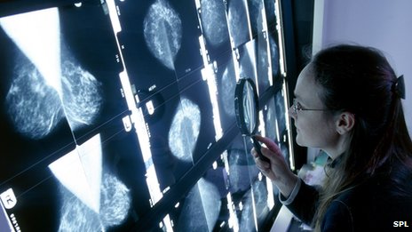 Deprivation responsible for 450 breast cancer deaths each year