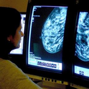 Breast cancer deaths lowest for 100 years