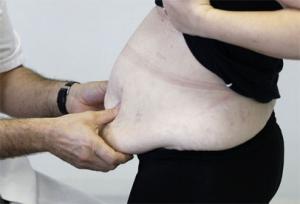 Nearly a third of adults are obese worldwide