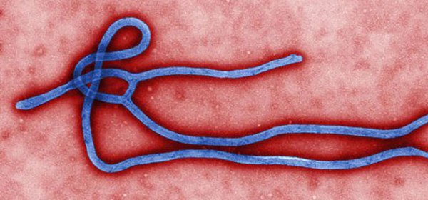 US is Responsible for the Ebola Outbreak in West Africa: Liberian Scientist